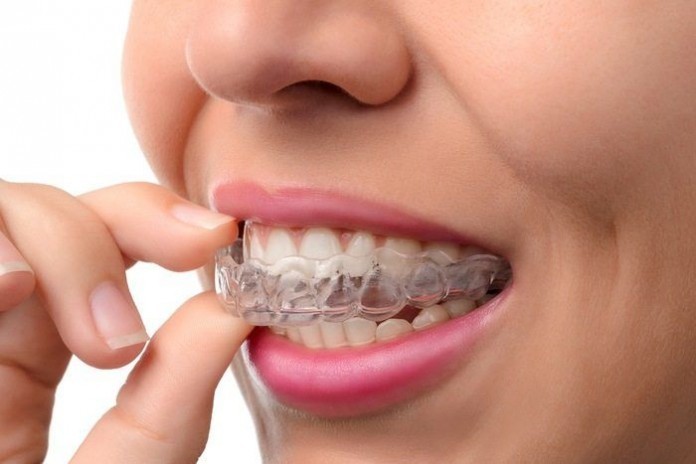 Woman Wearing Orthodontic Silicone Trainer braces