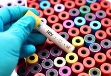 Labor HIV testing drug