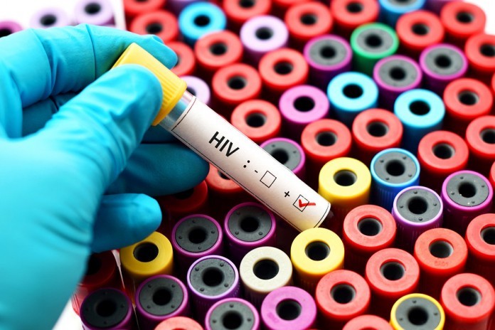 Labor’s $53 million plan to'make HIV history' in Australia Labor HIV testing drug