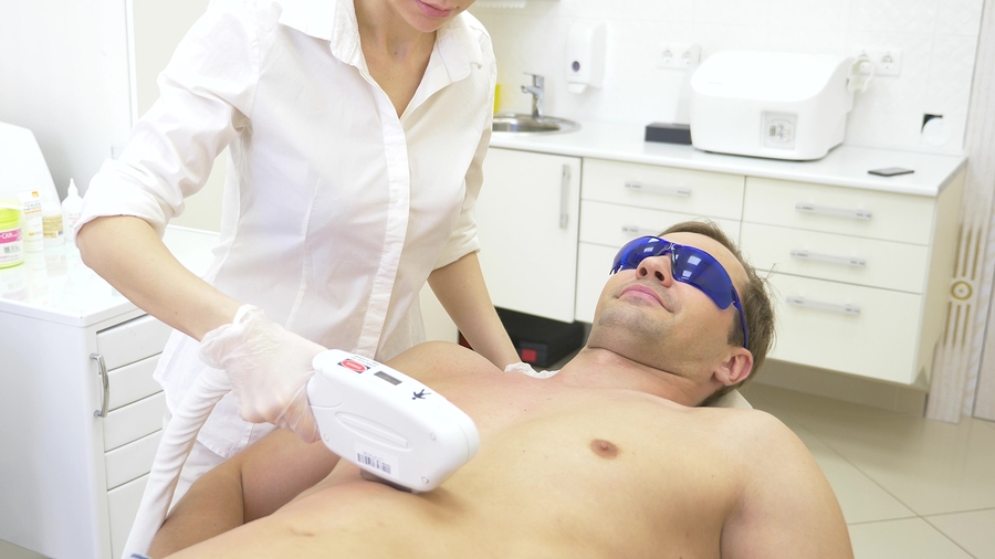 male laser hair removal. a doctor in white gloves removes hair from the abdomen and breasts of a man. close-up.