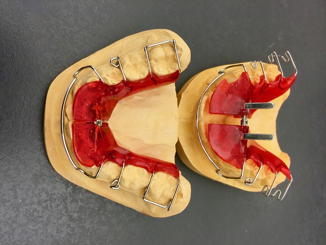 Overview of retainer