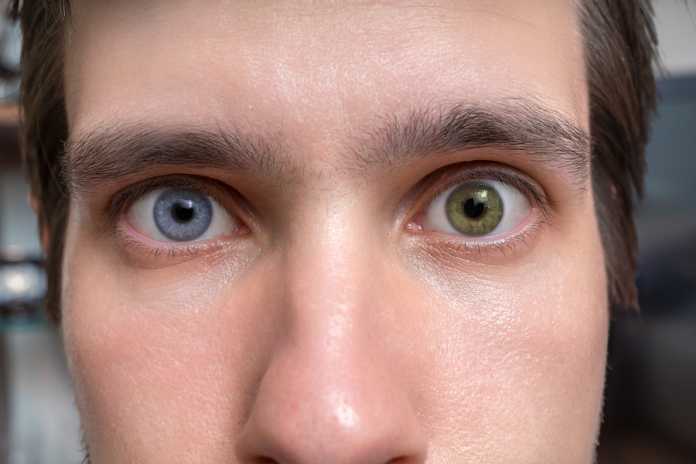 UV Lenses are the Perfect Addition to your Halloween Costume UV Lenses are the Perfect Addition to your Halloween Costume