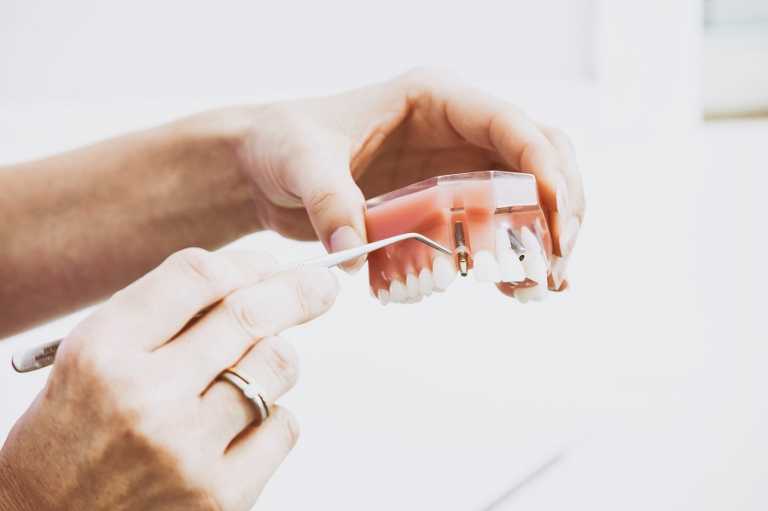 A beginner's guide on maintaining and coping with dentures