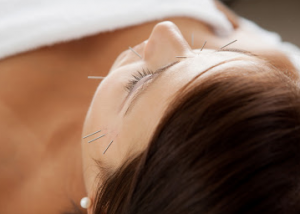 Fusion Acupuncture & Natural Therapies