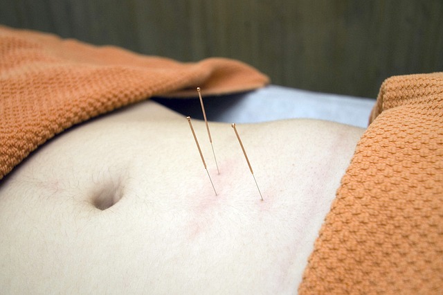 Best Acupuncture Clinics in Adelaide