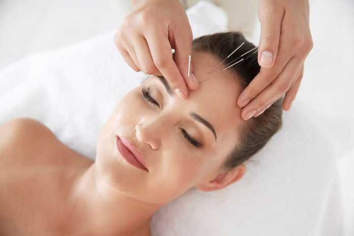 Best Acupuncture Specialists in Melbourne Best Acupuncture Specialists in Melbourne