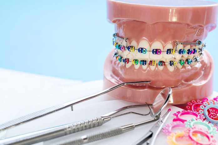 Best Orthodontics in Melbourne Best Orthodontics in Melbourne