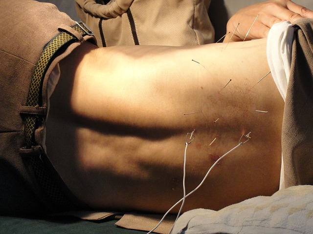 Best Acupuncture in Gold Coast