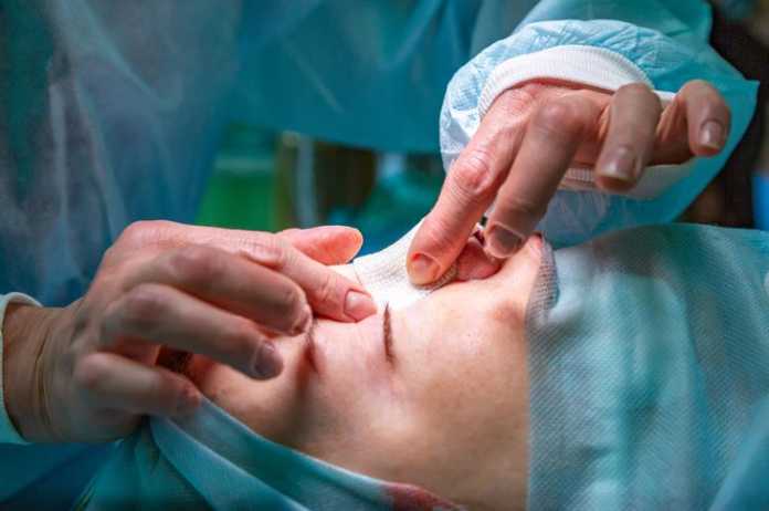 Best Plastic Surgeons in Canberra Best Plastic Surgeons in Canberra