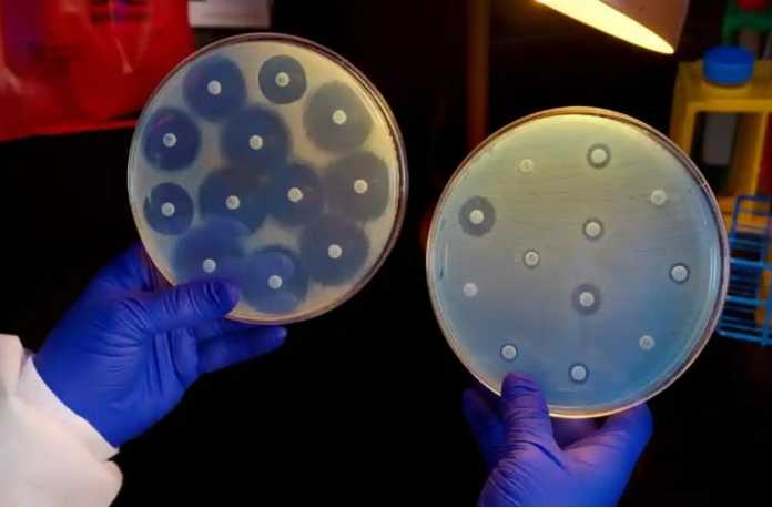 Scientists warn public as bacteria develop new ways to thwart antibiotics
